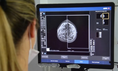 Prevención del cáncer de mama: el gobierno bonaerense comenzará a indicar la mamografía a los 40 años