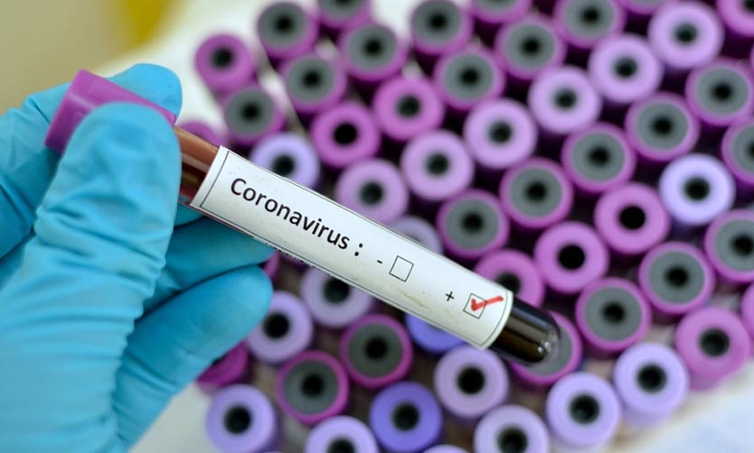 Coronavirus en Argentina: Son 79 las víctimas fatales y 1.894 los infectados