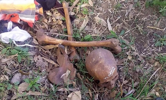 Un hombre encontró restos humanos dentro de una bolsa